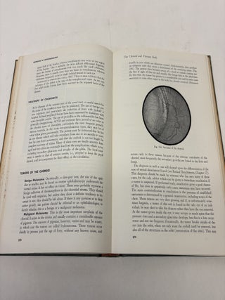 GIFFORD'S TEXTBOOK OF OPHTHALMOLOGY